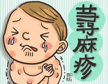 荨麻疹应该怎么预防